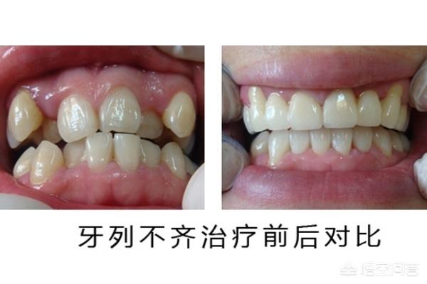 天津最新24小时牙医在线咨询方法分析(最方便真实的天津有没有24小时牙医方法)